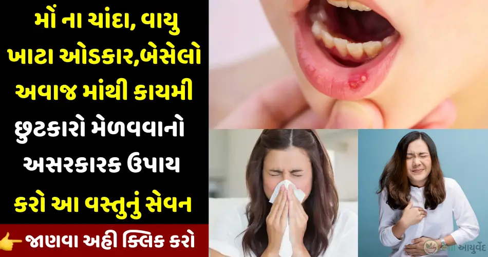 mouth ulcer home remedy
